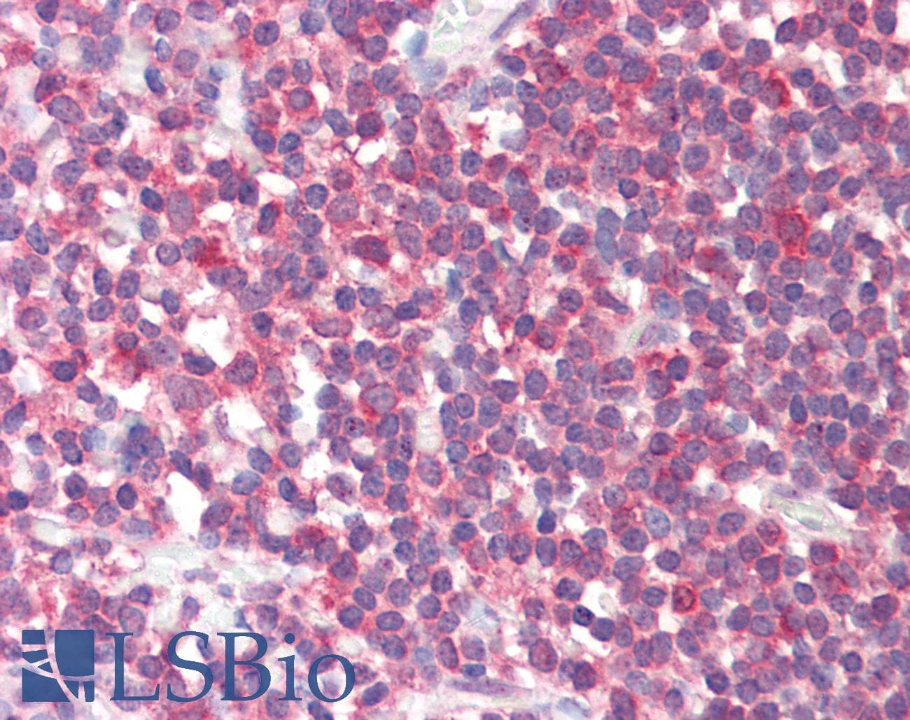 IHC-plus™ FTHFSDC1 / MTHFD1L Antibody (aa578-591)