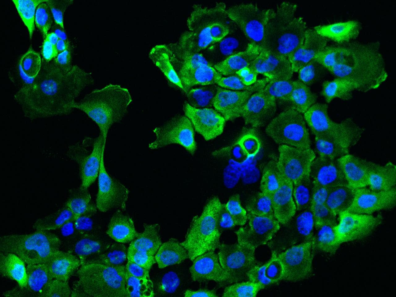 C1orf116 Antibody