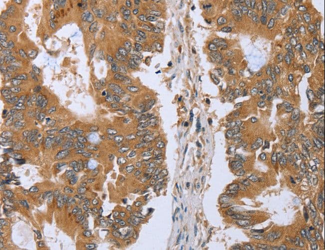 CLEC16A / KIAA0350 Antibody