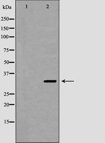 NAT1 / AAC1 Antibody