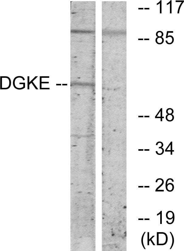 DGKE / DGK Epsilon Antibody
