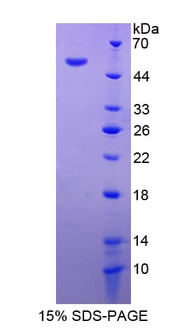 Human MASP1 / MASP Protein (Recombinant His-T7)