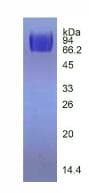 Human KDR / VEGFR2 / FLK1 Protein (Recombinant His, N-Terminal)