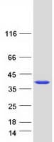 Human AIDA Protein (Recombinant Myc-DDK (Flag))
