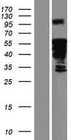 DACH2 Protein (Over-Expression Lysate Myc-DDK (Flag))