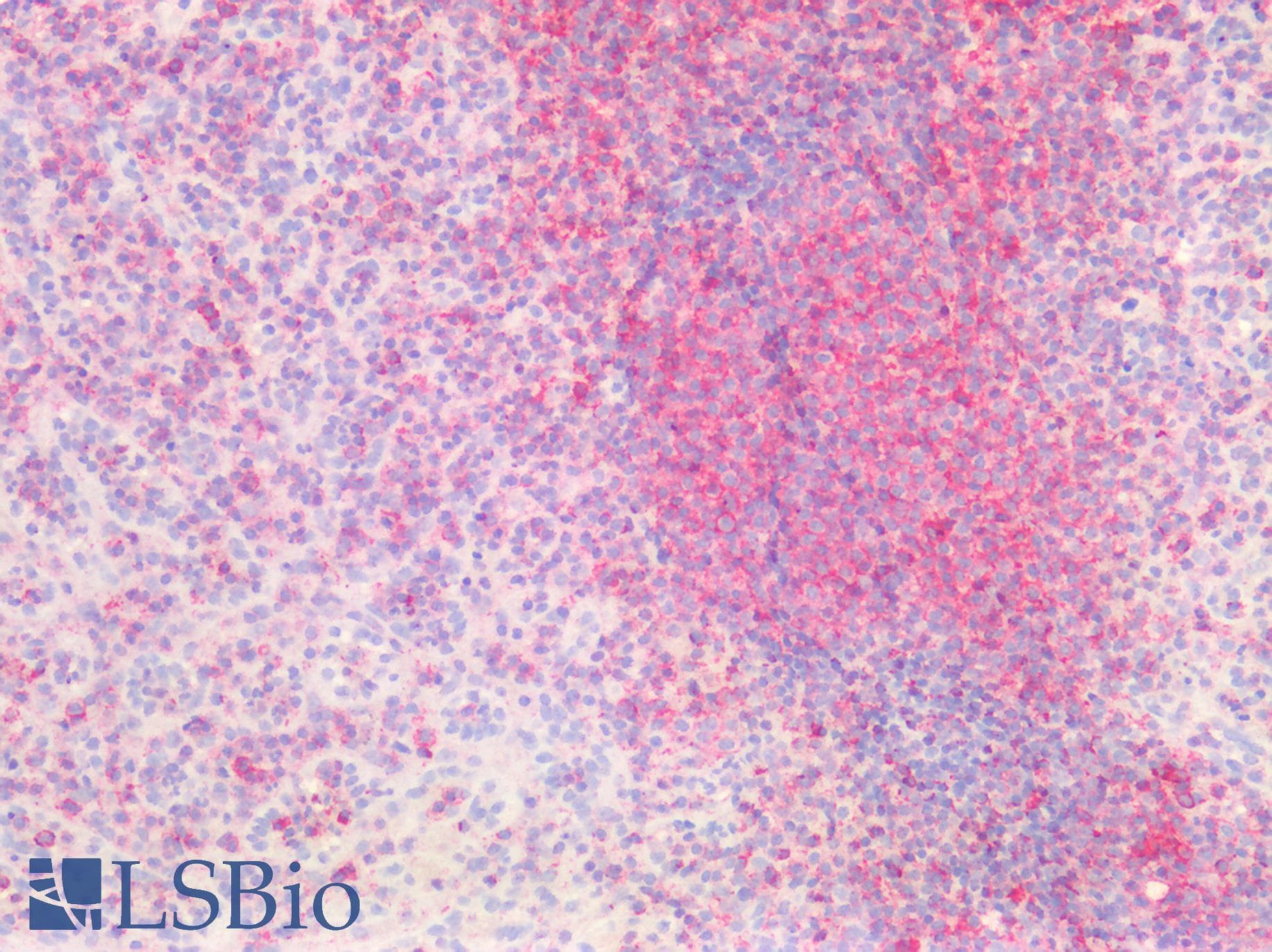 PathPlus™ CD44 Antibody (aa149-163)