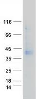 Human GPRC5A / RAI3 Protein (Recombinant Myc-DDK (Flag))