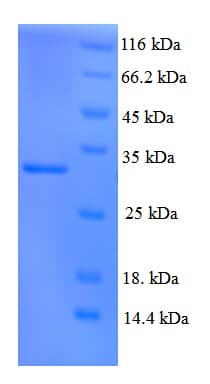 Human XPC Protein (Recombinant His)