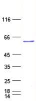 Human PTEN Protein (Recombinant His, N-Terminal)