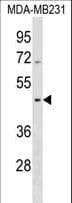 SEPT12 / Septin 12 Antibody (aa218-244)