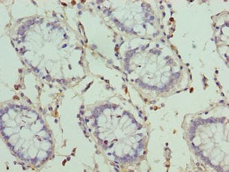 Polyclonal Rabbit anti-Human HKDC1 Antibody (IHC, WB)