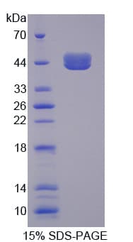 Human TCN1 Protein (Recombinant His)