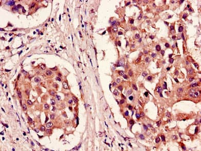 PSMB5 Antibody
