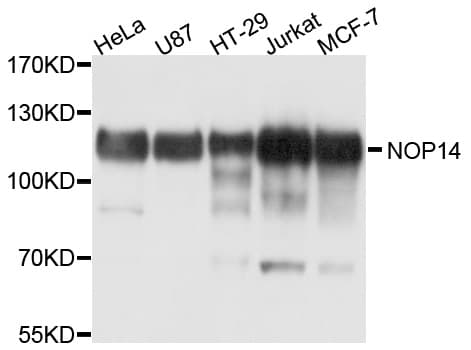 Polyclonal Rabbit anti-Human NOP14 / C4orf9 Antibody (WB)