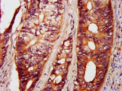 Polyclonal Rabbit anti-Human PAK4 Antibody (IHC)
