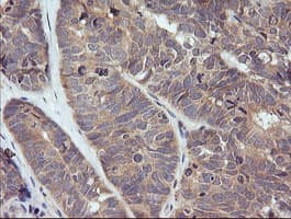 TRIM38 Antibody (aa1-265, clone OTI15A3, Carrier-free)