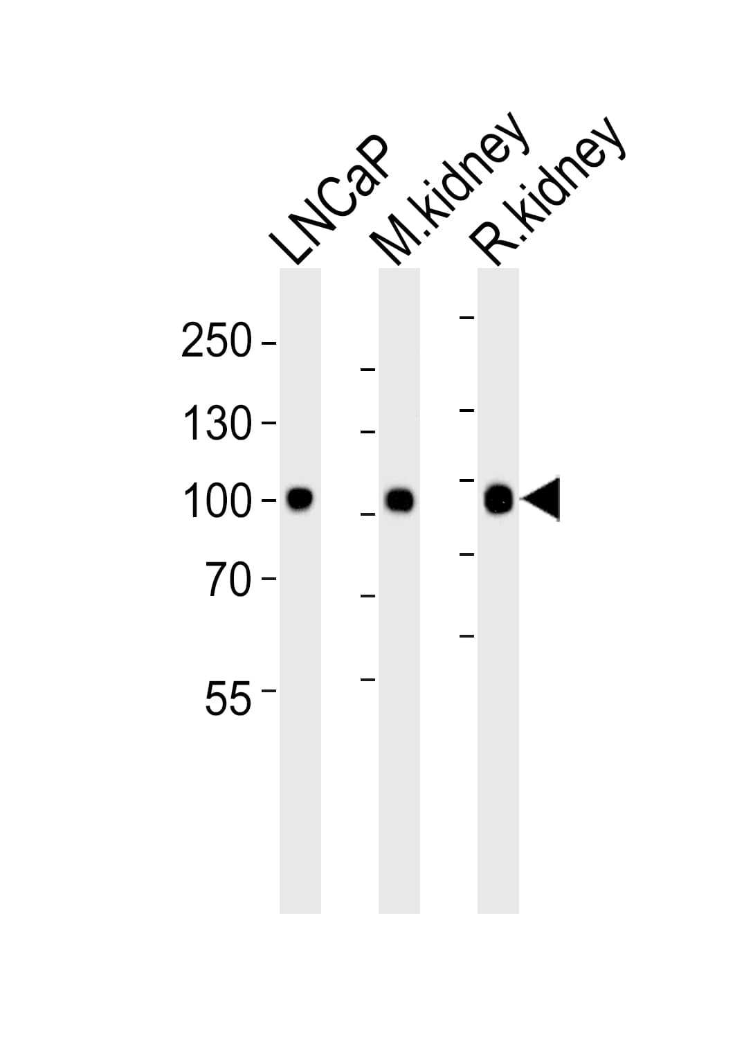 MME / CD10 Antibody (aa492-525)