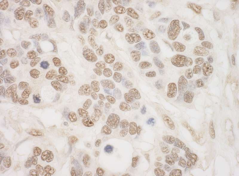 RPS6KA4 / MSK2 / RSK-B Antibody (aa722-772)