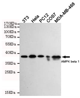 PRKAB1 / AMPK Beta 1 Antibody