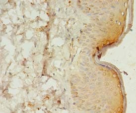 SPANXC / SPANX-C Antibody
