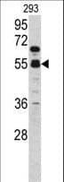 Polyclonal Rabbit anti-Human F10 / Factor X Antibody (aa351-381, IHC, WB)
