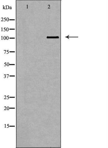 Polyclonal Rabbit anti-Human PIWIL2 Antibody (IHC, WB)