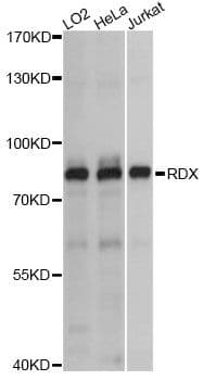 Polyclonal Rabbit anti-Human RDX / Radixin Antibody (WB)