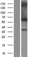 MUTYH / MYH Protein (Over-Expression Lysate Myc-DDK (Flag))