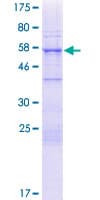 Human NUP35 / NUP53 Protein (Recombinant GST)