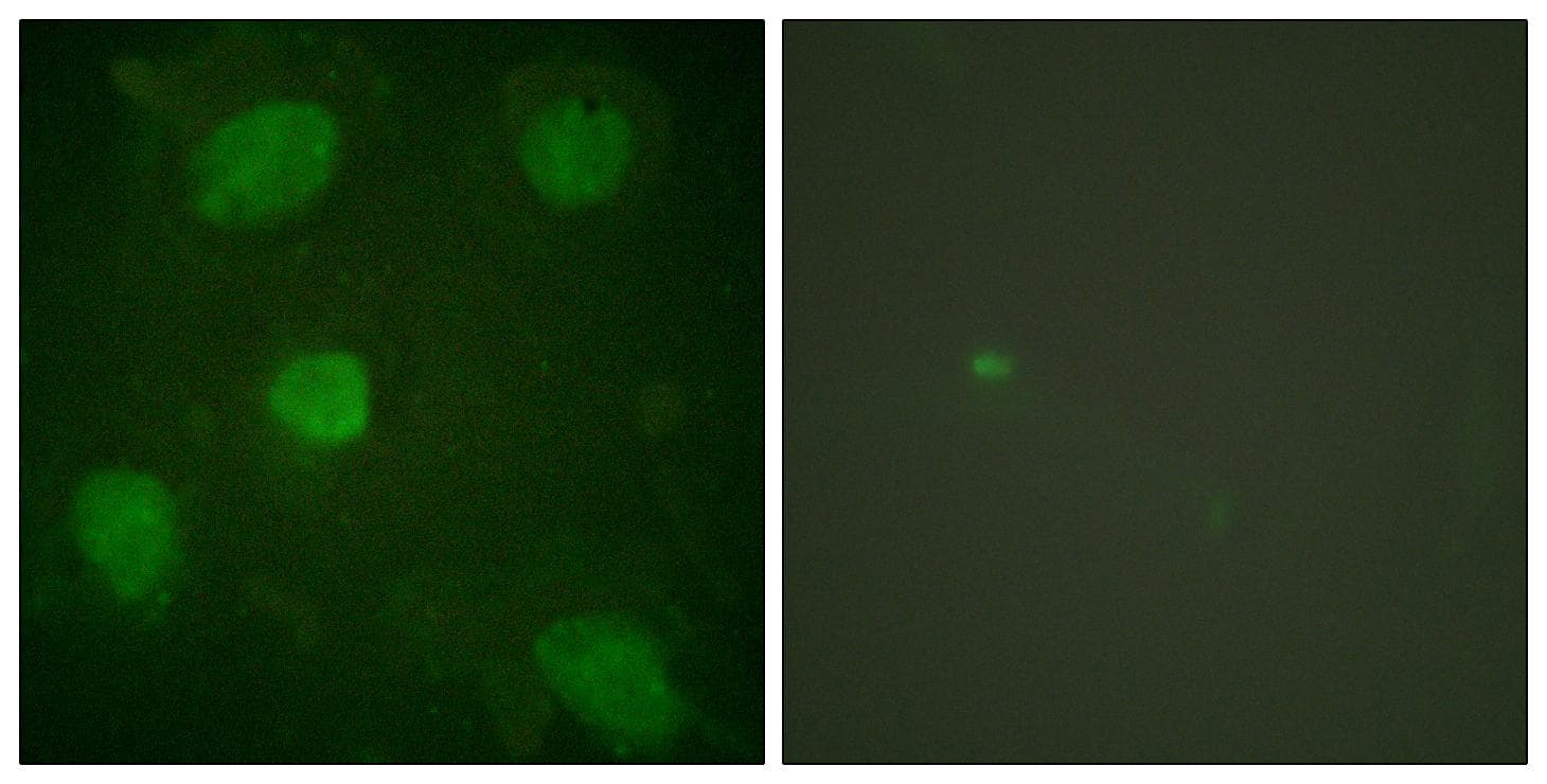 ARA55 / HIC-5 Antibody (Ab-60)