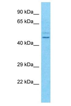 Polyclonal Rabbit anti-Human TSPYL5 Antibody (aa19-68, WB)