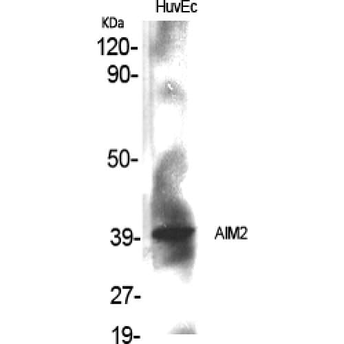 AIM2 Antibody (30-110 aa, Internal)