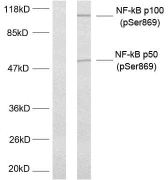 NFKB2 Antibody (phospho-Ser869)