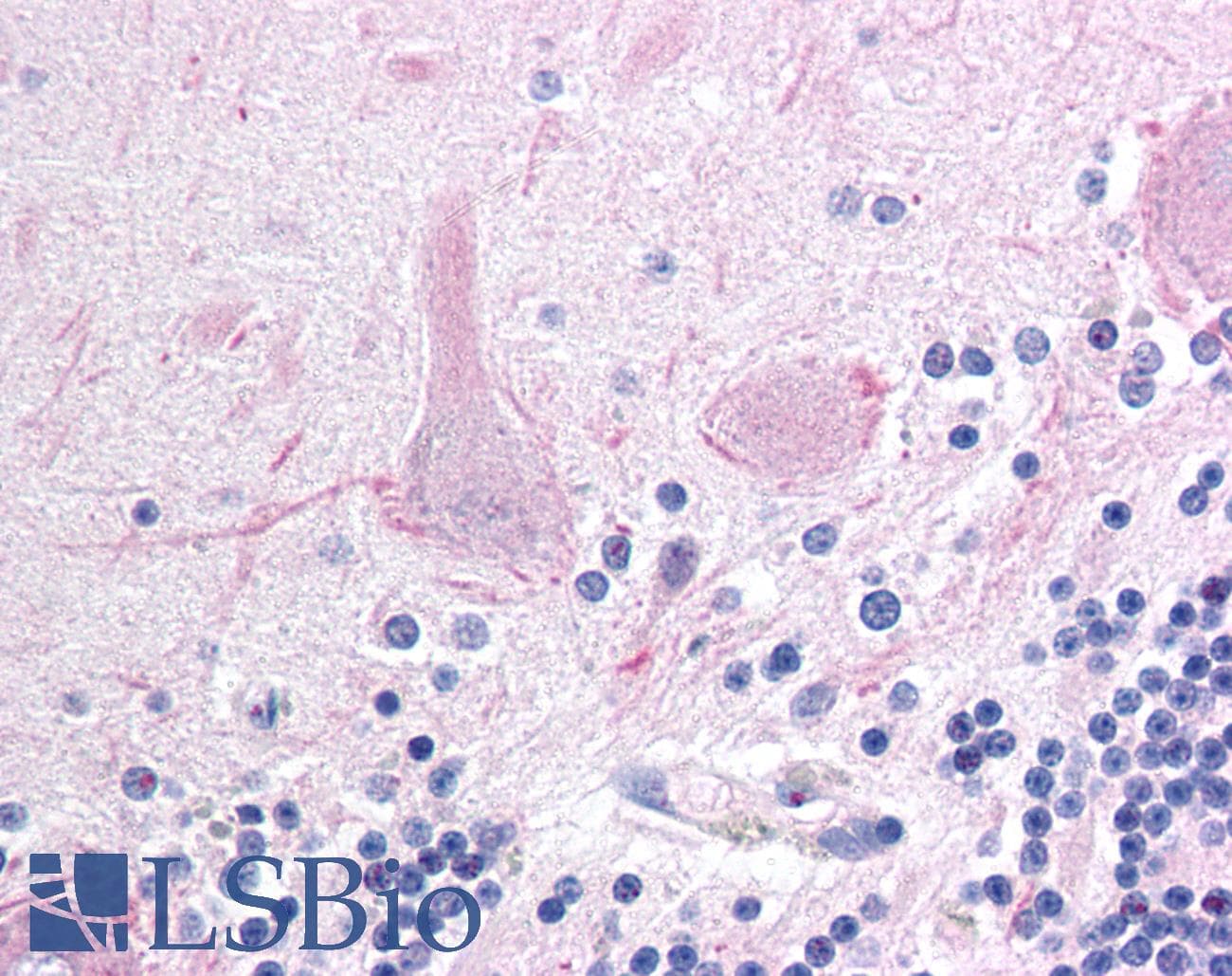 IHC-plus™ AFF1 / AF4 Antibody (aa1190-1203)