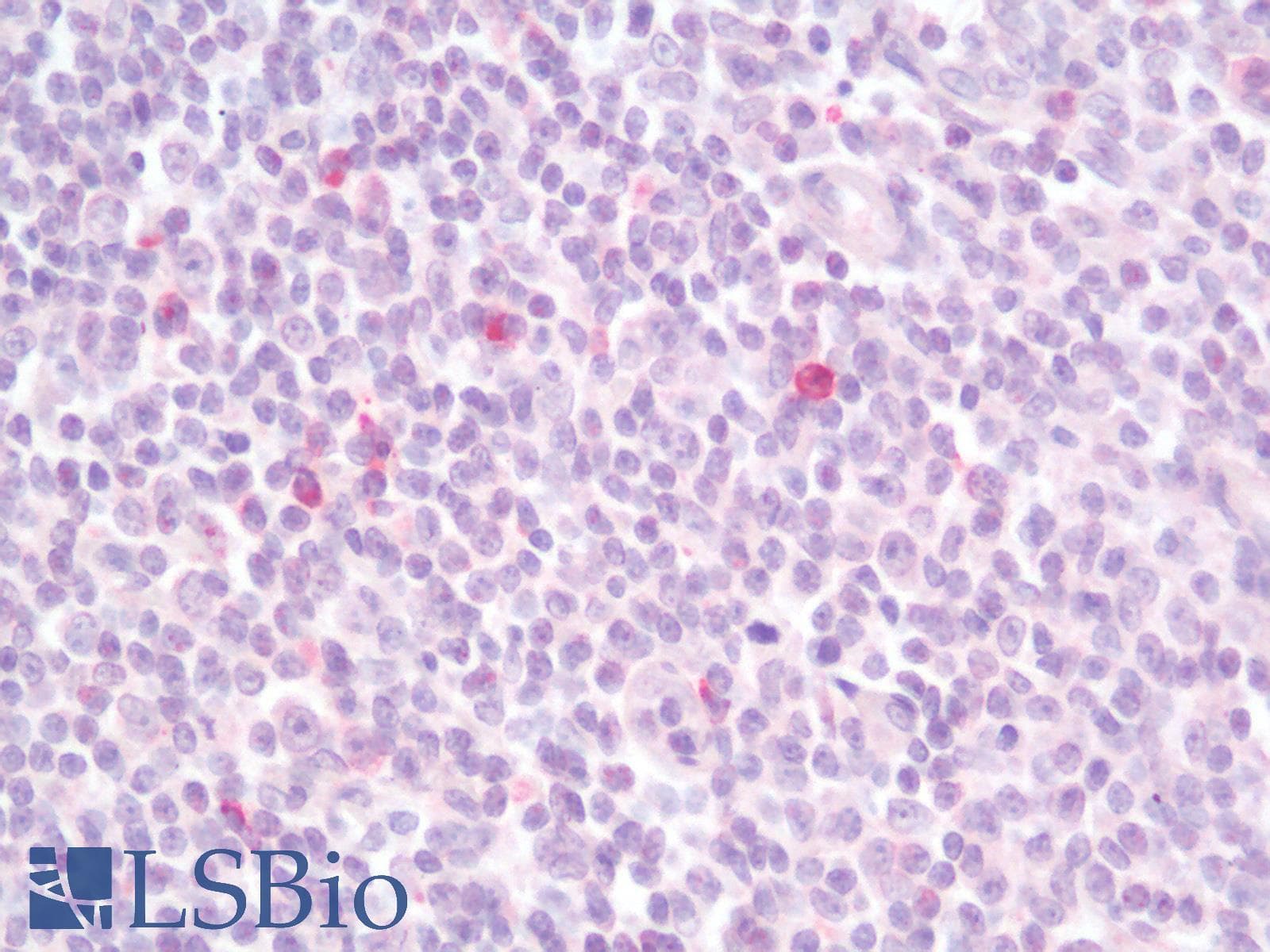 IHC-plus™ LAG3 Antibody