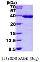 Human TPM1 / Tropomyosin Protein (Recombinant His)