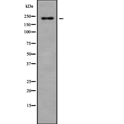 HPTPB / PTPRB Antibody