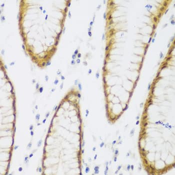 Polyclonal Rabbit anti-Human BRD9 Antibody (IHC, WB)
