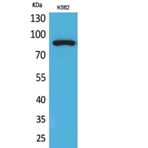 HSP90 / Heat Shock Protein 90 Antibody (acetylation site of K292/284.)