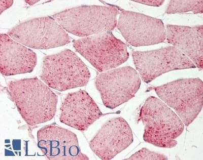IHC-plus™ CDK4 Antibody (aa1-50)