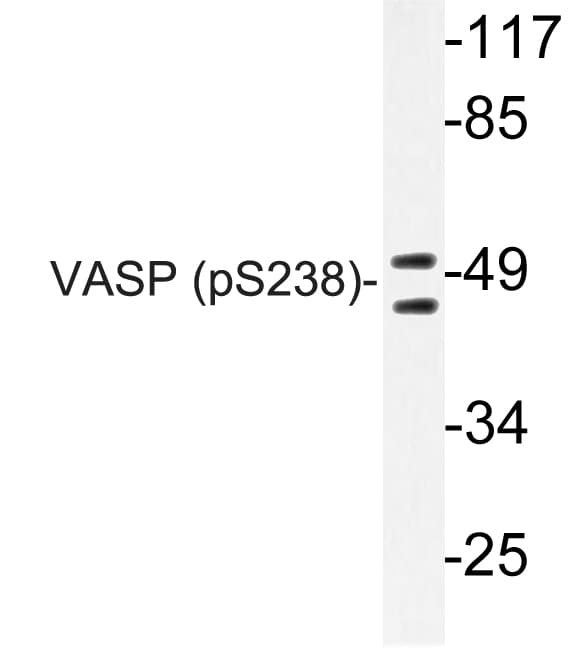 Polyclonal Rabbit anti-Human VASP Antibody (phospho-Ser238, IHC, WB)