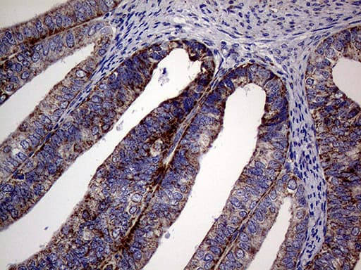 Monoclonal Mouse anti-Human MRPL15 Antibody (clone OTI10B10, aa28-296, IHC, WB)