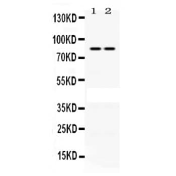 Polyclonal Rabbit anti-Human PLA2G4A Antibody (aa682-721, WB)