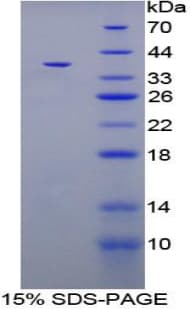 Rat CPB / Carboxypeptidase B Protein (Recombinant His-T7)