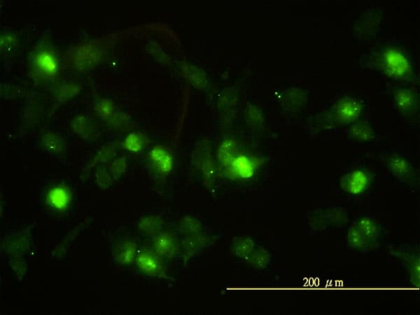 ANXA2 / Annexin A2 Antibody (clone 3E8-B6)