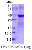 Human LIN28B Protein (Recombinant His)