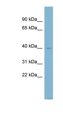 NDUFA9 Antibody (aa35-84)
