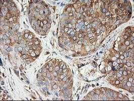 Monoclonal Mouse anti-Human TUBB4 / Tubulin Beta 4 Antibody (clone 6C2, Carrier-free, IHC, IF, WB)