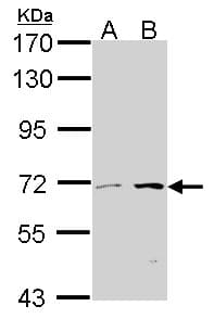 COT / CROT Antibody (aa140-462)