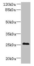 Polyclonal Rabbit anti-Human C11orf53 Antibody (IHC, WB)